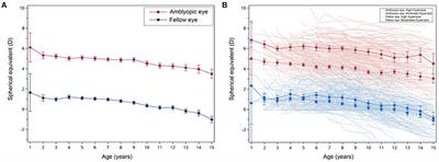 Refraction development in anisometropic amblyopia with patching therapy
